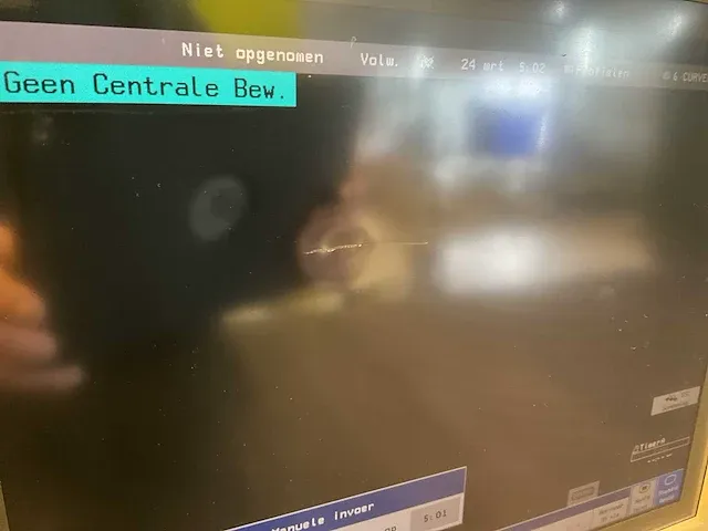 10x phillips intellivue mp70 patiëntmonitor - afbeelding 13 van  21