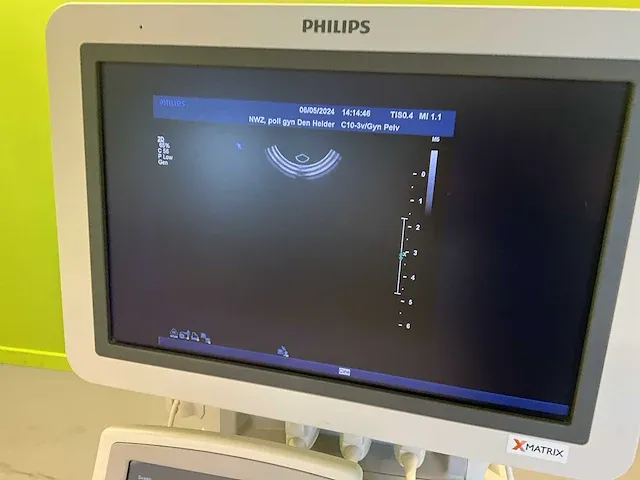 2007 philips iu22 echografieapparaat - afbeelding 5 van  12