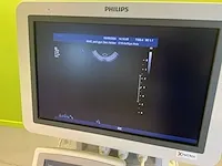 2007 philips iu22 echografieapparaat - afbeelding 5 van  12