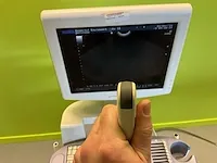 2008 aloka prosound ssd-3500sx ultrasoonapparaat - afbeelding 2 van  18