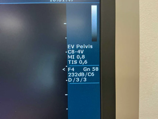 2009 philips hd7 echo toestel - afbeelding 4 van  9