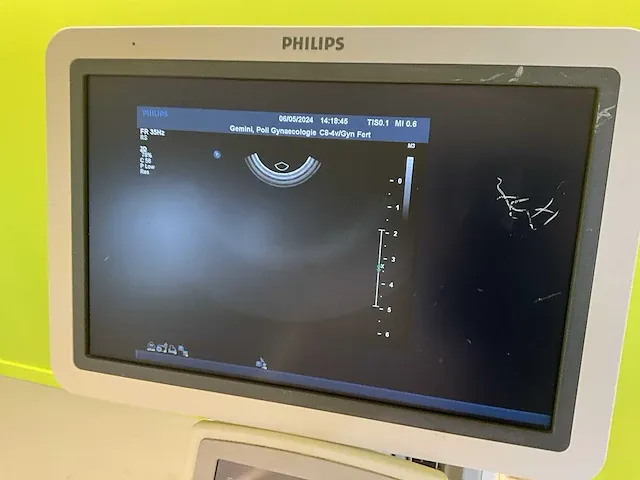 2009 philips iu22 echografieapparaat - afbeelding 6 van  13