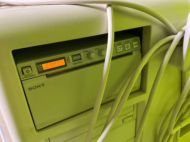 2010 philips hd11xs echografie machine - afbeelding 14 van  14