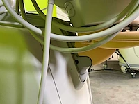 2010 philips iu22 - echografie apparaat - afbeelding 2 van  15