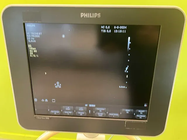2012 philips clearvue 550 ultrasoonapparaat - afbeelding 3 van  10