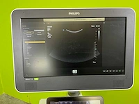2021 philips affiniti 70w ultra sound machine - afbeelding 26 van  27