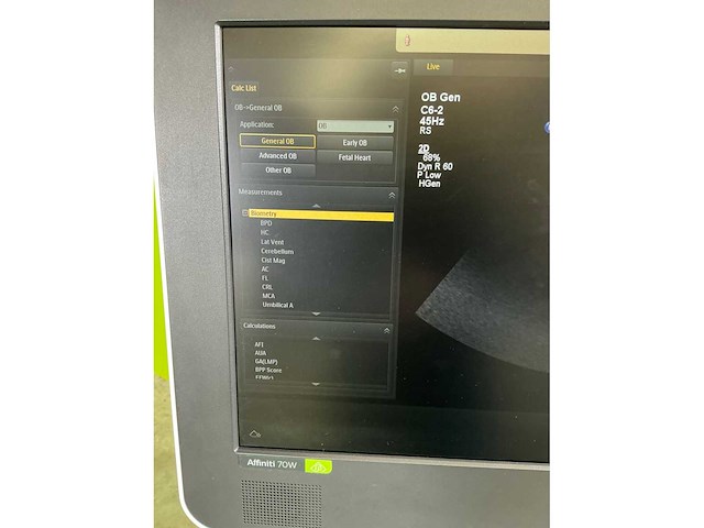 2021 philips affiniti 70w ultra sound machine - afbeelding 3 van  27