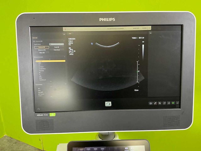 2021 philips affiniti 70w ultra sound machine - afbeelding 26 van  27