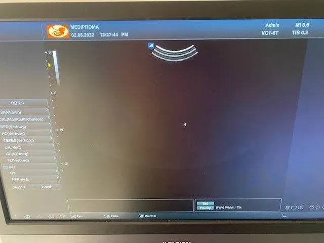 Alpinion - e-cube 8 - ultrasound equipment - afbeelding 8 van  9