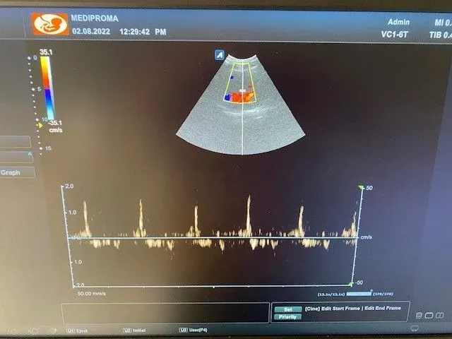 Alpinion - e-cube 8 - ultrasound equipment - afbeelding 9 van  9