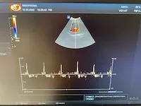 Alpinion - e-cube 8 - ultrasound equipment - afbeelding 9 van  9