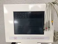 Bioset 8000 elektrocardiograph kar - afbeelding 3 van  7