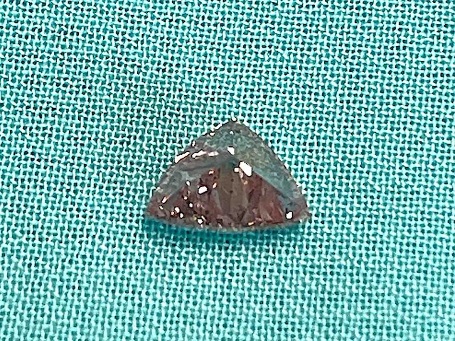 Diamant - 0.76 carat echte fancy roze gekleurde unieke diamant (gecertificeerd) - afbeelding 2 van  5
