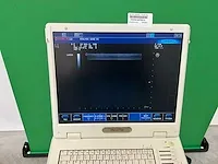 Esaote - mylab five - echoapparaat - afbeelding 4 van  10