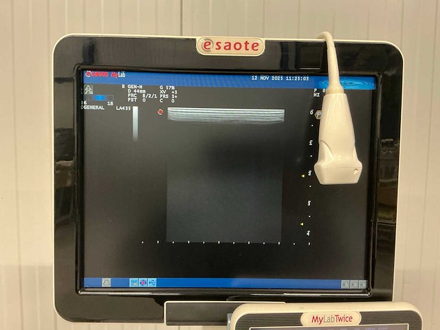 Esaote - mylabtwice - echo apparaat - afbeelding 11 van  12