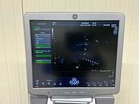 Ge healthcare - voluson s6 - echo toestel - afbeelding 8 van  8