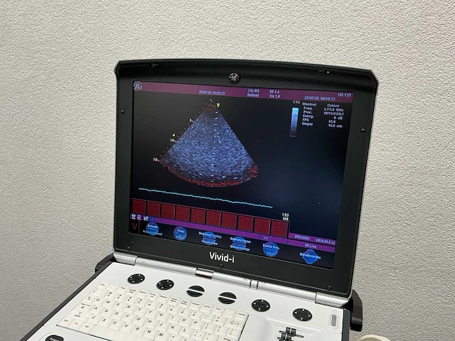 Ge healthcare vivid-i echocardiografie toestel - afbeelding 4 van  9