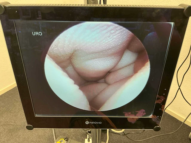 Hologic mysure 40-200 0 graden hysteroscope - afbeelding 3 van  4