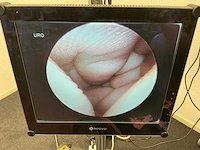 Hologic mysure 40-200 0 graden hysteroscope - afbeelding 3 van  4