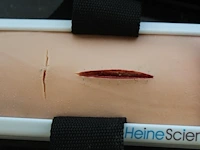 Huidhechting trainer heine scientific - afbeelding 2 van  2