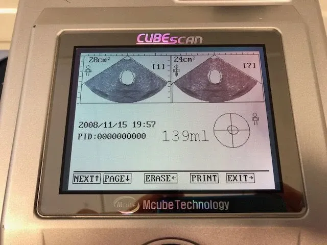 Mcube - biocon-500 - bladderscan - afbeelding 2 van  5
