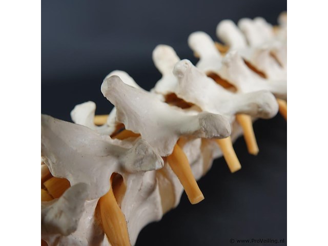 Menselijk wervelkolom cervicaal model - afbeelding 2 van  10