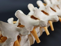 Menselijk wervelkolom cervicaal model - afbeelding 2 van  10