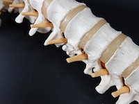 Menselijk wervelkolom cervicaal model - afbeelding 8 van  10