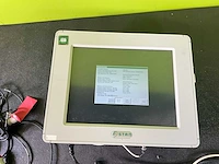 Neoventa stan s31 patiëntmonitor - afbeelding 7 van  14