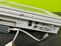 Neoventa stan s31 patiëntmonitor - afbeelding 4 van  8