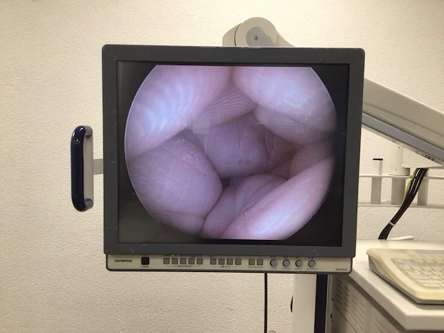 Olympus - evis exera ii cv-180 - endoscopietoren - afbeelding 6 van  8