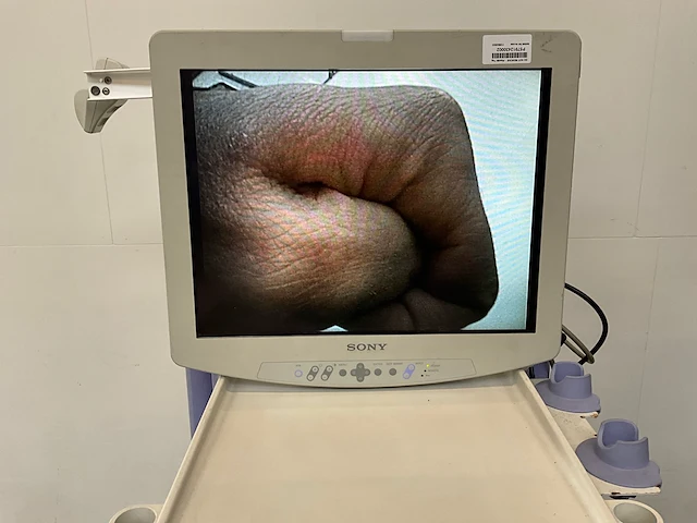 Olympus elvis exera ii laparoscopic stack system - afbeelding 2 van  9