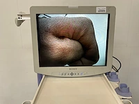 Olympus elvis exera ii laparoscopic stack system - afbeelding 2 van  9