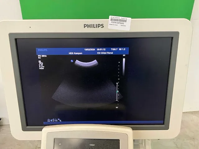 Philips - iu22 - echo apparaat - 2008 - afbeelding 4 van  11