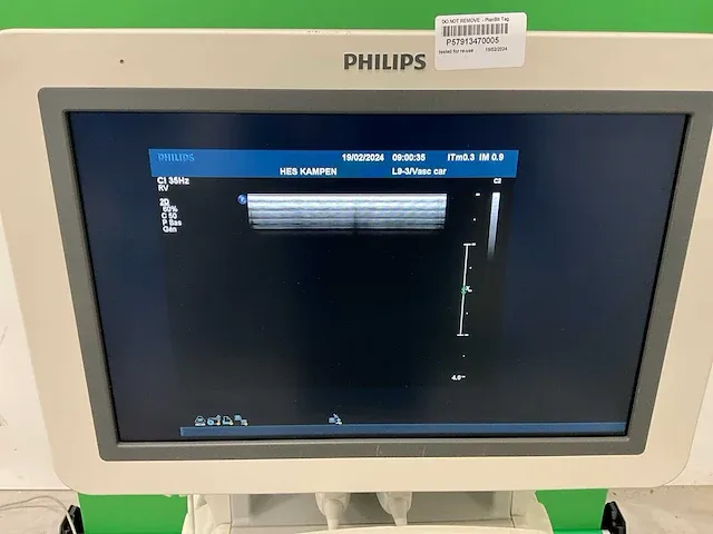 Philips - iu22 - echografieapparaat - 2012 - afbeelding 5 van  11