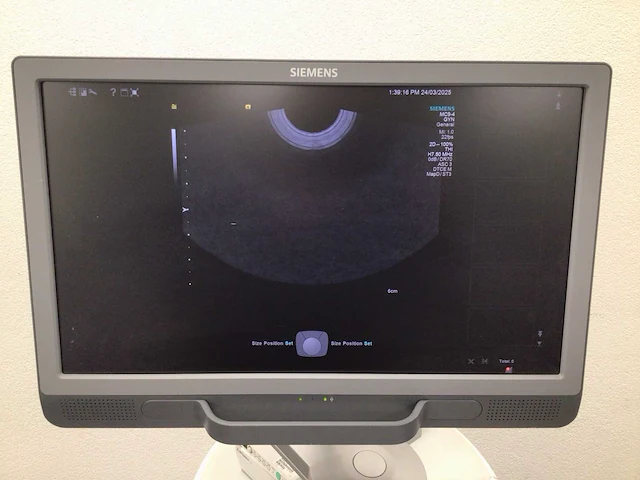 Siemens - acuson s1000 - echografietoestel - afbeelding 7 van  13