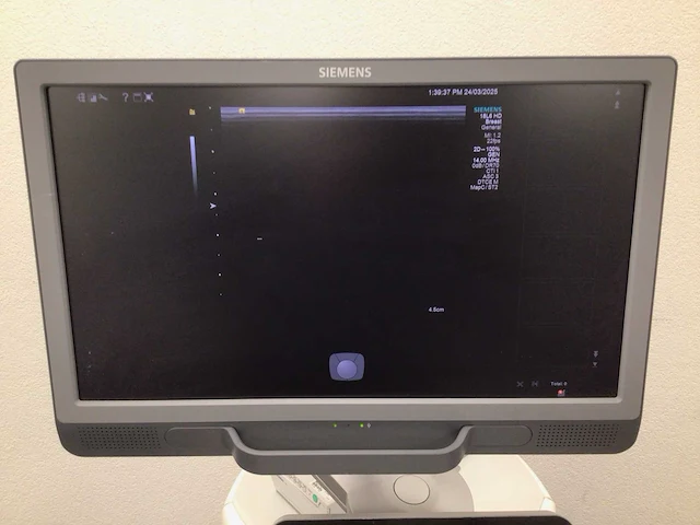 Siemens - acuson s1000 - echografietoestel - afbeelding 9 van  13