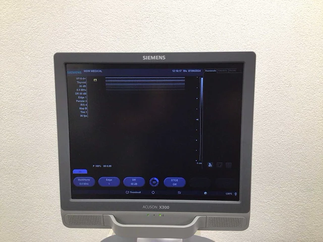 Siemens acuson x300 echo apparaat - afbeelding 2 van  6