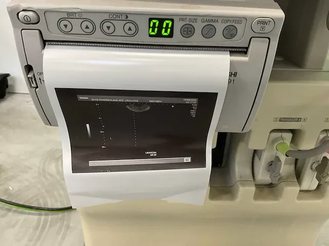 Toshiba - nemio 20 - echo apparaat - 2005 - afbeelding 10 van  10