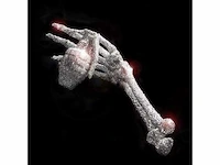 Verzamelobject “granaat arm” - afbeelding 2 van  9