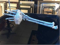 Verzamelobject “granaat arm”