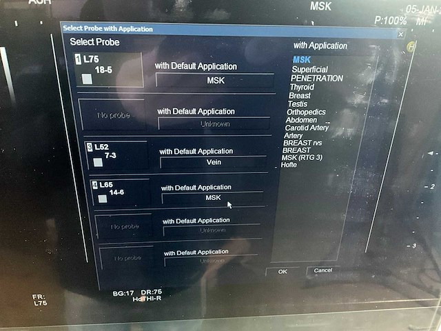 2012 hitachi hi vision ascendus ultra sound machine - afbeelding 6 van  11