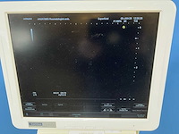 2012 hitachi hi vision avius ultra sound machine - afbeelding 7 van  12