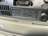2015 hitachi nablus ultra sound machine - afbeelding 9 van  10