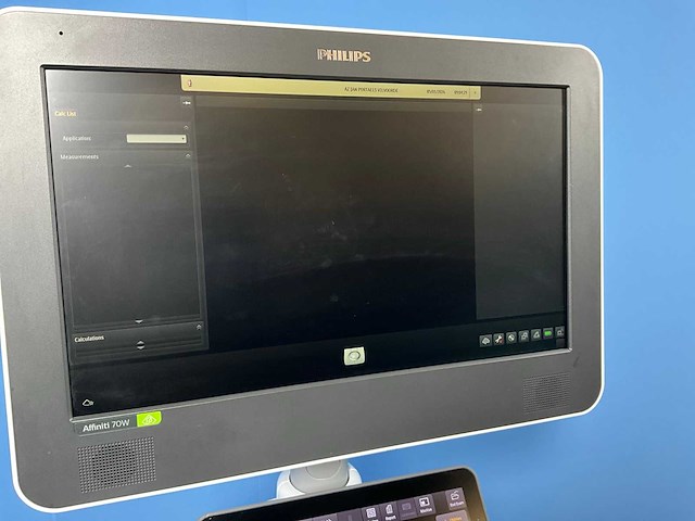 2021 philips affiniti 70w ultra sound machine - afbeelding 15 van  15