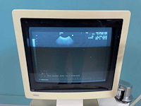 Aloka - 55d-1000 - echoscopisch apparaat - 2005 - afbeelding 6 van  10