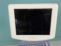 Aloka - prosound 6 - echo-apparaat - 2013 - afbeelding 4 van  7
