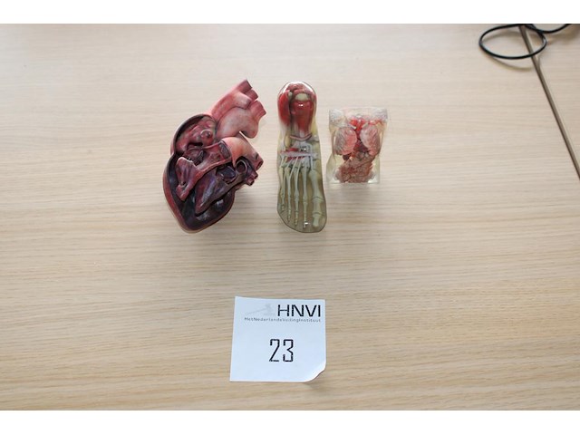 Anatomische producten w.o. hart, voet en romp. - afbeelding 1 van  3