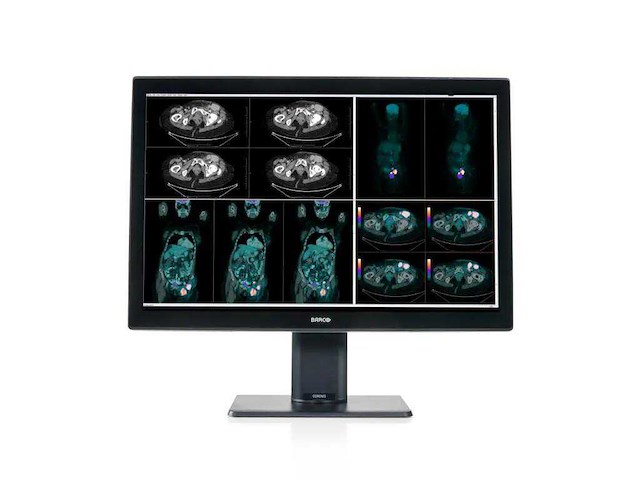 Barco mdcc-4130 medische monitor - afbeelding 1 van  6