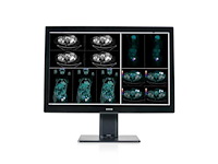 Barco mdcc-4130 medische monitor - afbeelding 1 van  6